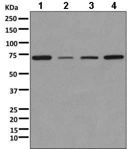 Western blot - Anti-KBTBD11 antibody [EPR10056(2)(B)] - BSA and Azide free (AB249501)