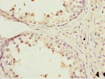 Immunohistochemistry (Formalin/PFA-fixed paraffin-embedded sections) - Anti-KBTBD7 antibody (AB230126), expandable thumbnail