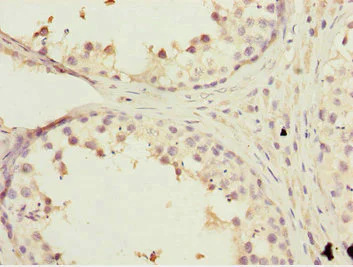 Immunohistochemistry (Formalin/PFA-fixed paraffin-embedded sections) - Anti-KBTBD7 antibody (AB230126)