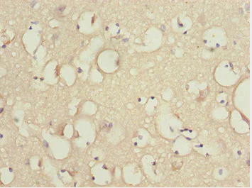 Immunohistochemistry (Formalin/PFA-fixed paraffin-embedded sections) - Anti-KBTBD7 antibody (AB230126)