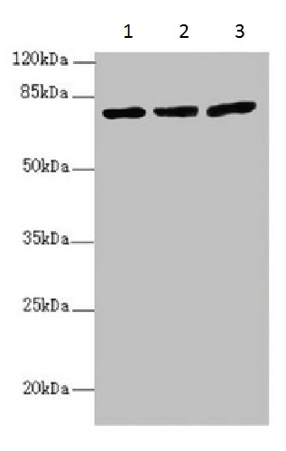 Western blot - Anti-KBTBD7 antibody (AB230126), expandable thumbnail