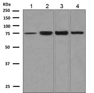 Western blot - Anti-KBTBD8 antibody [EPR10698(B)] - BSA and Azide free (AB249086)
