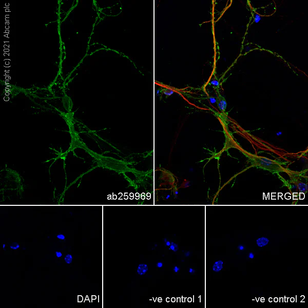 Immunocytochemistry/ Immunofluorescence - Anti-KCC2 antibody [EPR24203-85] - BSA and Azide free (AB283588)