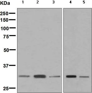 Western blot - Anti-KCHIP1 antibody [EPR7624] (AB133753)