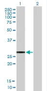 Western blot - Anti-KChIP2 antibody (AB88542)