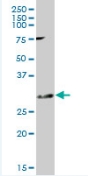 Western blot - Anti-KChIP2 antibody (AB88542)
