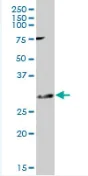 Western blot - Anti-KChIP2 antibody (AB88542)