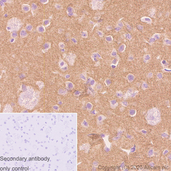 Immunohistochemistry (Formalin/PFA-fixed paraffin-embedded sections) - Anti-KChIP2 antibody [K60/73] - BSA and Azide free (AB255763), expandable thumbnail