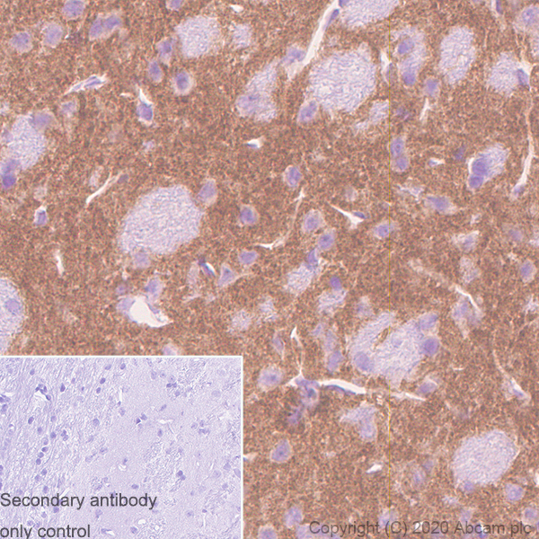 Immunohistochemistry (Formalin/PFA-fixed paraffin-embedded sections) - Anti-KChIP2 antibody [K60/73] - BSA and Azide free (AB255763), expandable thumbnail