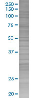 KChIP2 overexpression 293T lysate (whole cell)