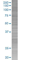 SDS-PAGE - KChIP2 overexpression 293T lysate (whole cell) (AB94274)