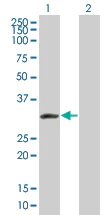 Western blot - KChIP2 overexpression 293T lysate (whole cell) (AB94274)