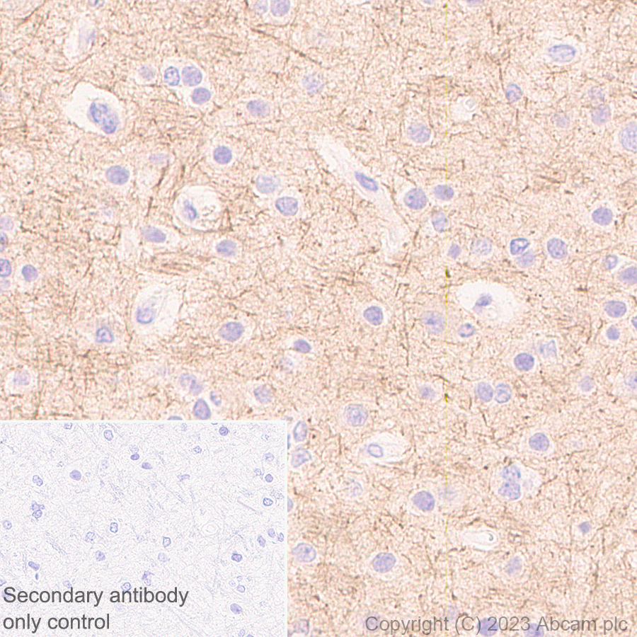 Immunohistochemistry (Formalin/PFA-fixed paraffin-embedded sections) - Anti-KCNA antibody [EPR26383-85] (ab313624), expandable thumbnail
