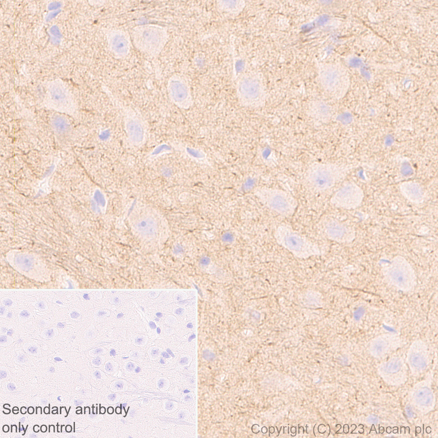 Immunohistochemistry (Formalin/PFA-fixed paraffin-embedded sections) - Anti-KCNA antibody [EPR26383-85] (ab313624), expandable thumbnail