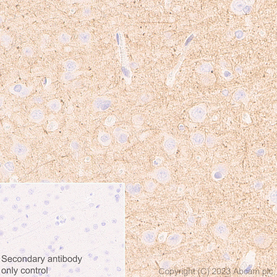 Immunohistochemistry (Formalin/PFA-fixed paraffin-embedded sections) - Anti-KCNA antibody [EPR26383-85] (ab313624), expandable thumbnail
