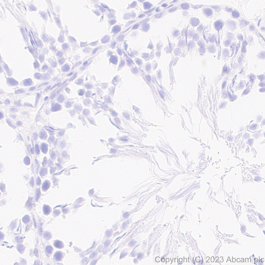 Immunohistochemistry (Formalin/PFA-fixed paraffin-embedded sections) - Anti-KCNA antibody [EPR26383-85] (ab313624), expandable thumbnail