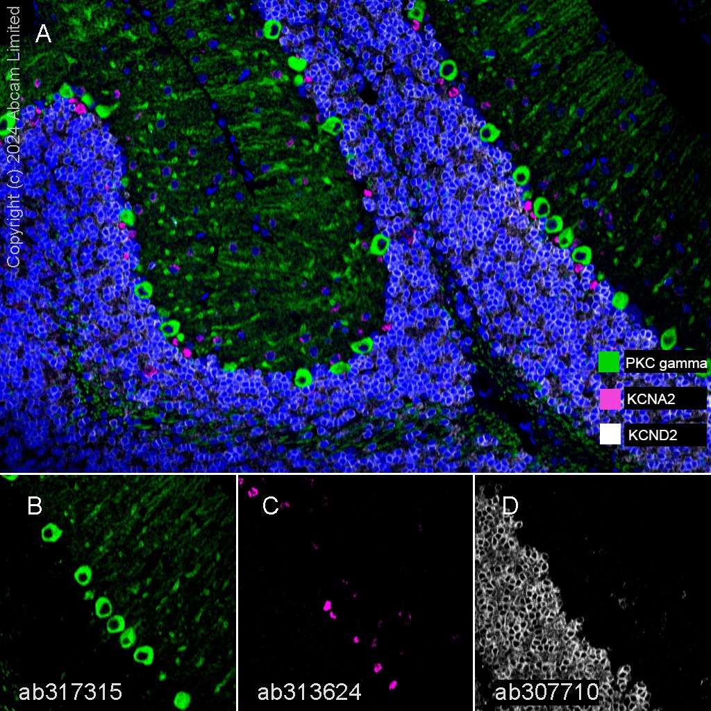 Multiplex immunohistochemistry - Anti-KCNA antibody [EPR26383-85] (ab313624), expandable thumbnail
