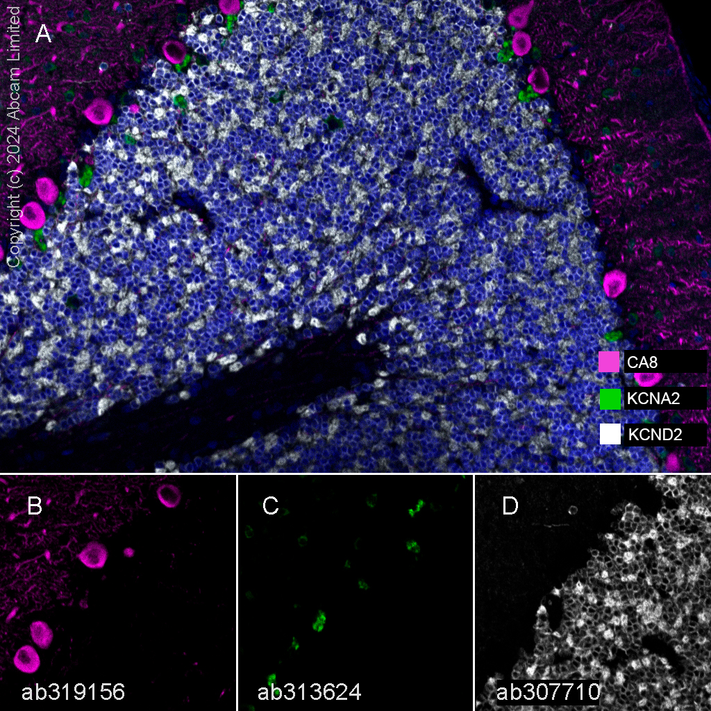 Multiplex immunohistochemistry - Anti-KCNA antibody [EPR26383-85] (AB313624), expandable thumbnail