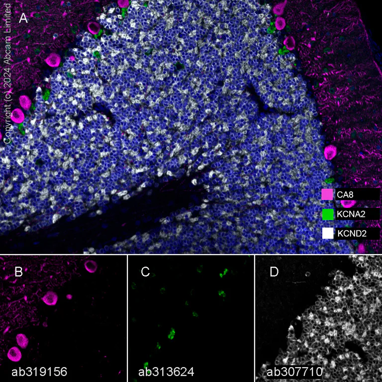 Multiplex immunohistochemistry - Anti-KCNA antibody [EPR26383-85] (AB313624)