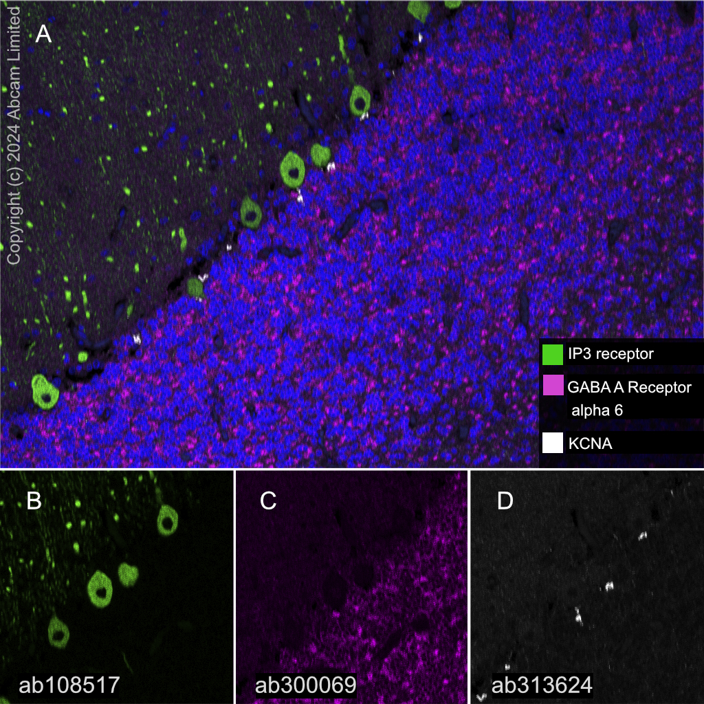 Multiplex immunohistochemistry - Anti-KCNA antibody [EPR26383-85] (AB313624)