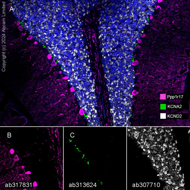 Multiplex immunohistochemistry - Anti-KCNA antibody [EPR26383-85] - BSA and Azide free (AB313625)