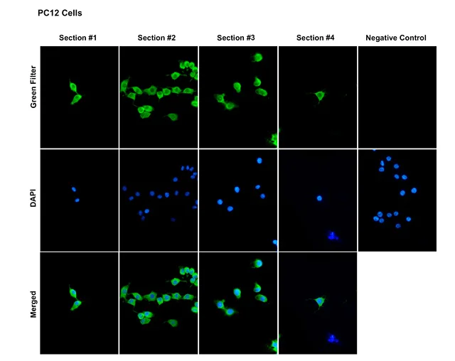 Immunocytochemistry/ Immunofluorescence - Anti-KCNA2 antibody [C25] (AB326350)