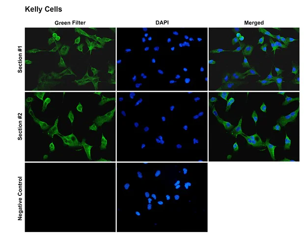 Immunocytochemistry/ Immunofluorescence - Anti-KCNA2 antibody [C25] (AB326350)