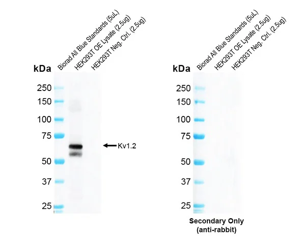 Western blot - Anti-KCNA2 antibody [C25] (AB326350)