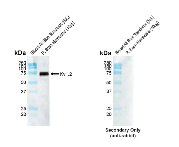 Western blot - Anti-KCNA2 antibody [C25] (AB326350)