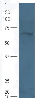 Western blot - Anti-KCNA3 antibody (AB216696)