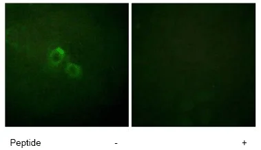 Immunocytochemistry/ Immunofluorescence - Anti-KCNA3 antibody (AB61200)