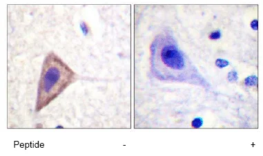 Immunohistochemistry (Formalin/PFA-fixed paraffin-embedded sections) - Anti-KCNA3 antibody (AB61200)