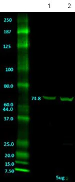 Western blot - Anti-KCNA5/KV1-5 antibody [2D10.D6] (AB184691)