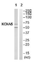 Western blot - Anti-KCNA5/KV1-5 antibody (AB110469), expandable thumbnail