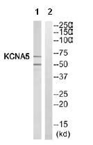 Western blot - Anti-KCNA5/KV1-5 antibody (AB110469)