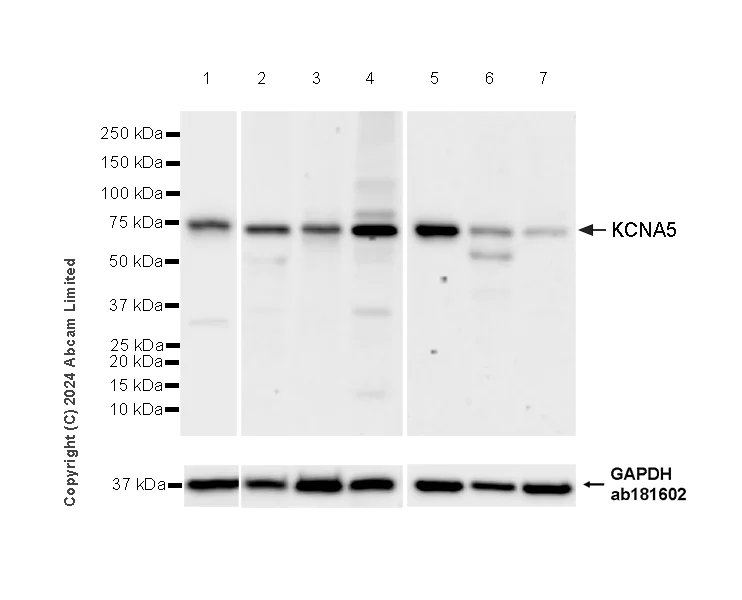Western blot - Anti-KCNA5/KV1-5 antibody [EPR27249-502] - BSA and Azide free (AB324821)