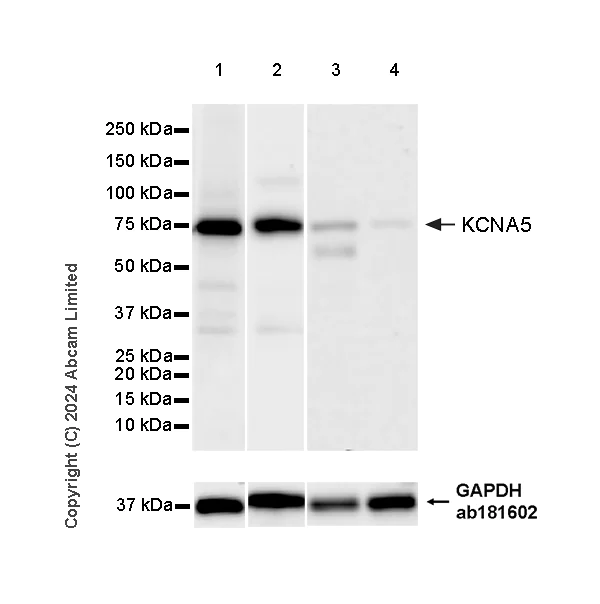 Western blot - Anti-KCNA5/KV1-5 antibody [EPR27249-502] - BSA and Azide free (AB324821)