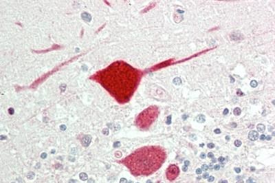 Immunohistochemistry (Formalin/PFA-fixed paraffin-embedded sections) - Anti-KCNC1 antibody (AB230686), expandable thumbnail
