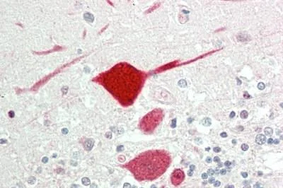 Immunohistochemistry (Formalin/PFA-fixed paraffin-embedded sections) - Anti-KCNC1 antibody (AB230686)