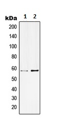 Western blot - Anti-KCNC1 antibody (AB230686), expandable thumbnail
