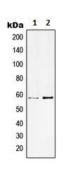 Western blot - Anti-KCNC1 antibody (AB230686)