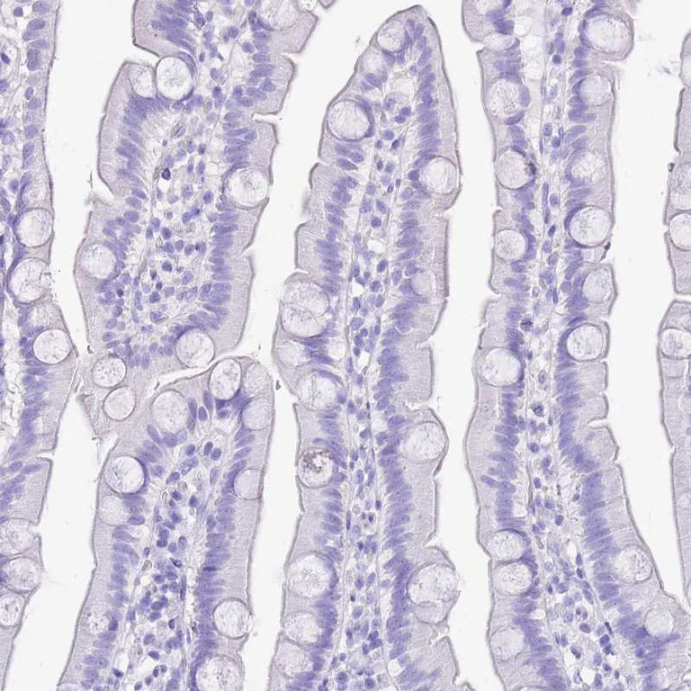 Immunohistochemistry (Formalin/PFA-fixed paraffin-embedded sections) - Anti-KCNC1 antibody (AB254906)