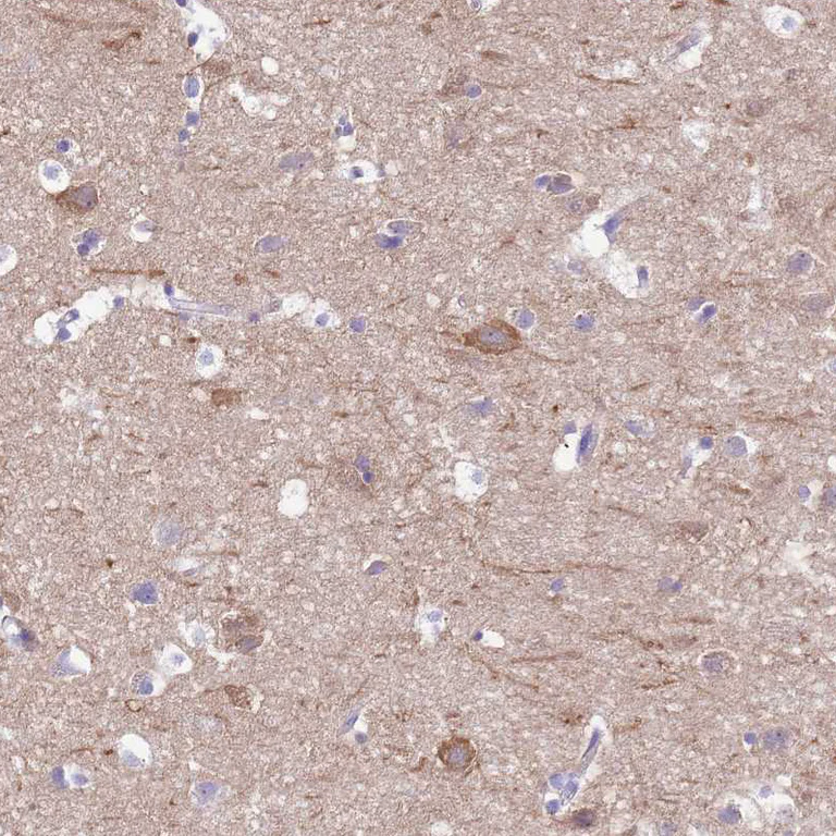 Immunohistochemistry (Formalin/PFA-fixed paraffin-embedded sections) - Anti-KCNC1 antibody (AB254906)