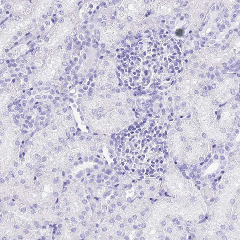 Immunohistochemistry (Formalin/PFA-fixed paraffin-embedded sections) - Anti-KCNC1 antibody (AB254906)
