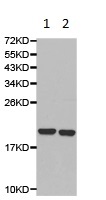 Western blot - Anti-KCNE1 antibody (AB180843)