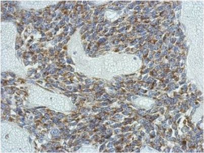 Immunohistochemistry (Formalin/PFA-fixed paraffin-embedded sections) - Anti-KCNG4 antibody (AB155772), expandable thumbnail