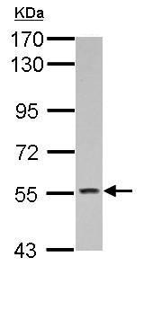 Western blot - Anti-KCNG4 antibody (AB155772), expandable thumbnail