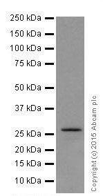 Western blot - Anti-KCNIP4 antibody [EPR18314] (AB203831), expandable thumbnail