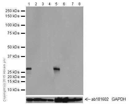 Western blot - Anti-KCNIP4 antibody [EPR18314] (AB203831), expandable thumbnail