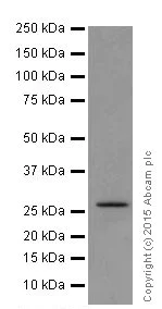 Western blot - Anti-KCNIP4 antibody [EPR18314] - BSA and Azide free (AB251403)